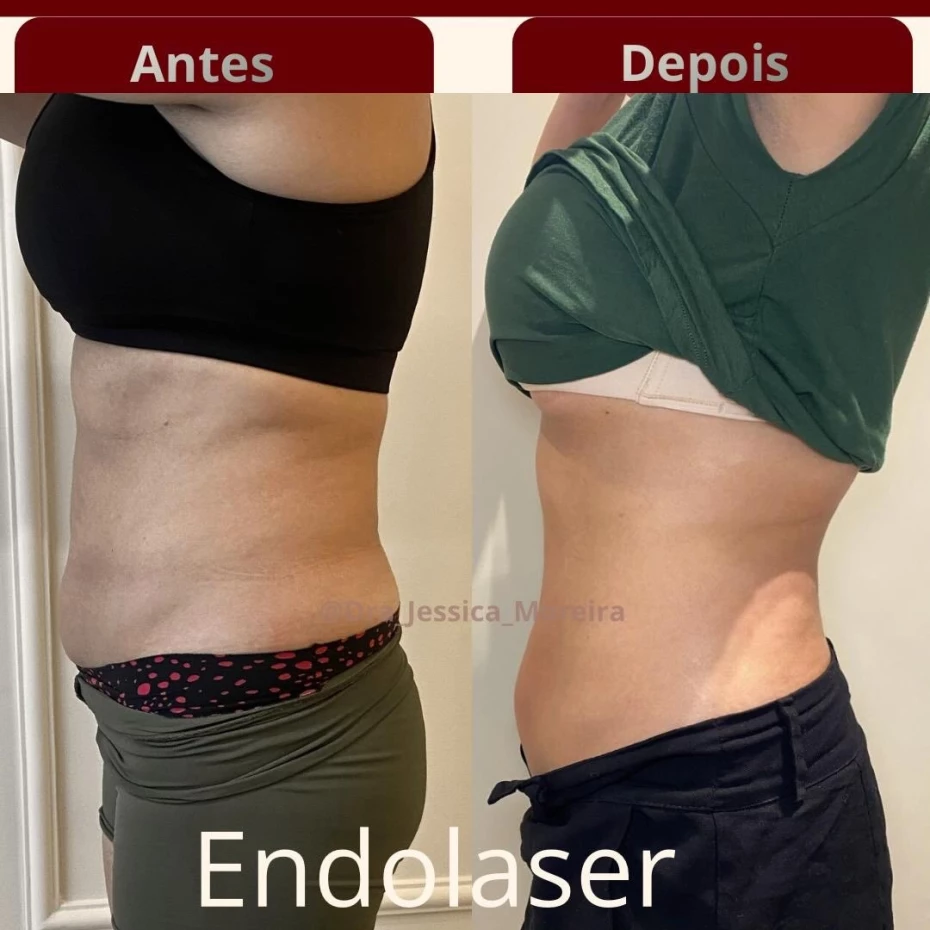Foto 7:  —  Clínica Dra. Jessica Moreira Saúde e Estética Especializada
