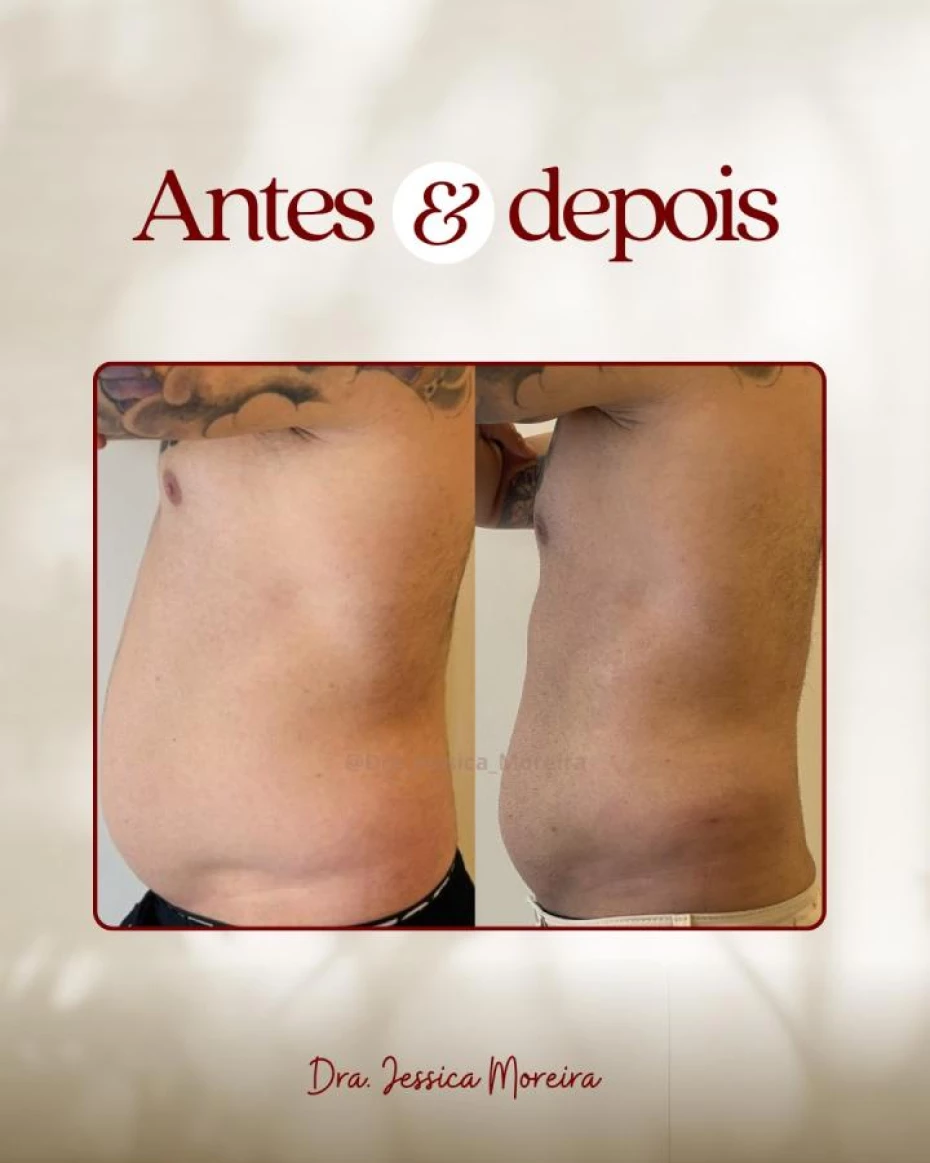 Foto 6:  —  Clínica Dra. Jessica Moreira Saúde e Estética Especializada
