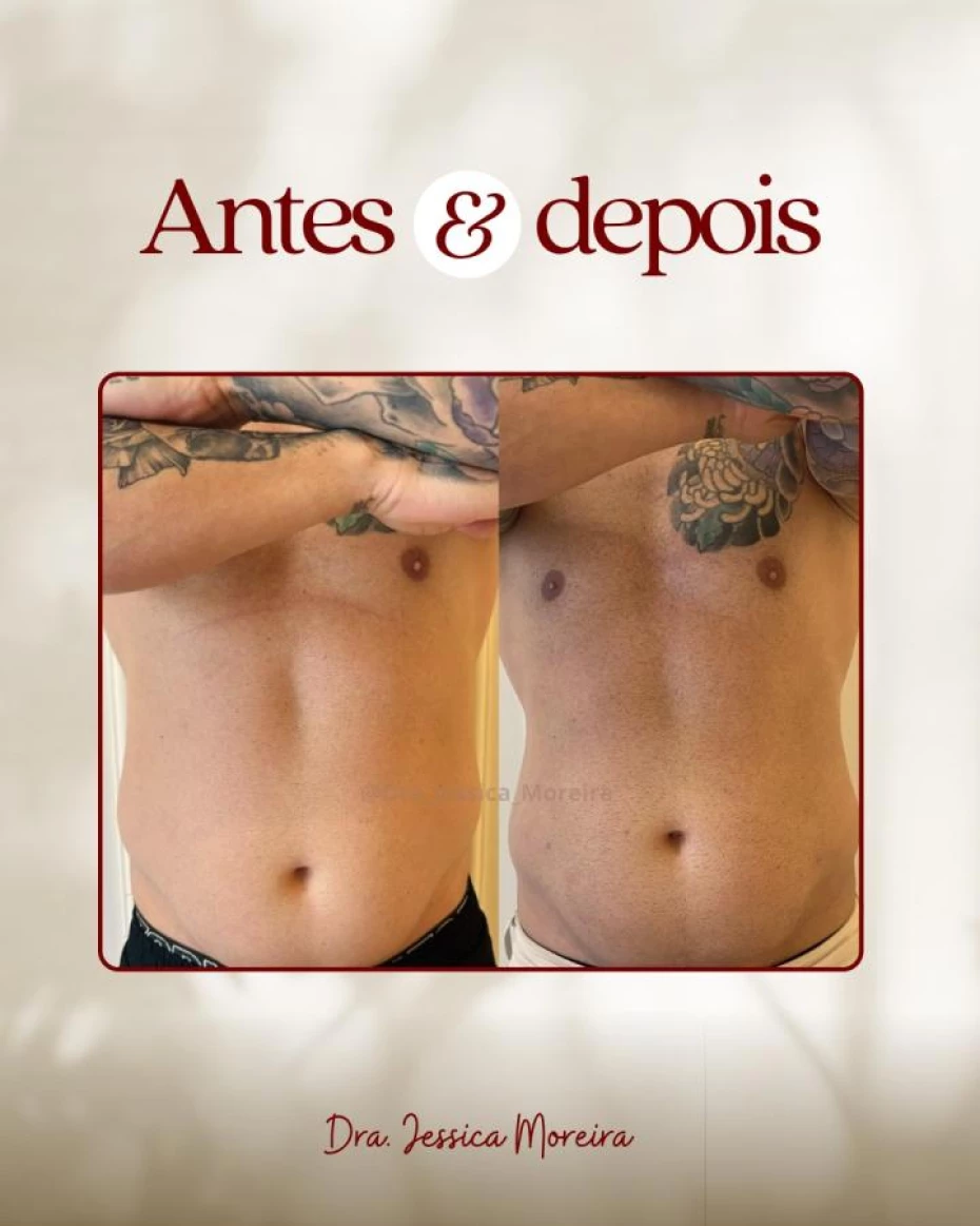 Foto 5:  —  Clínica Dra. Jessica Moreira Saúde e Estética Especializada