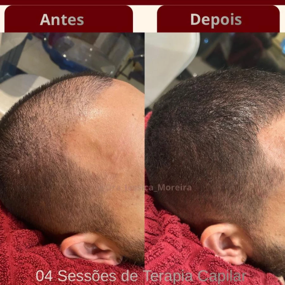 Foto 4:  —  Clínica Dra. Jessica Moreira Saúde e Estética Especializada