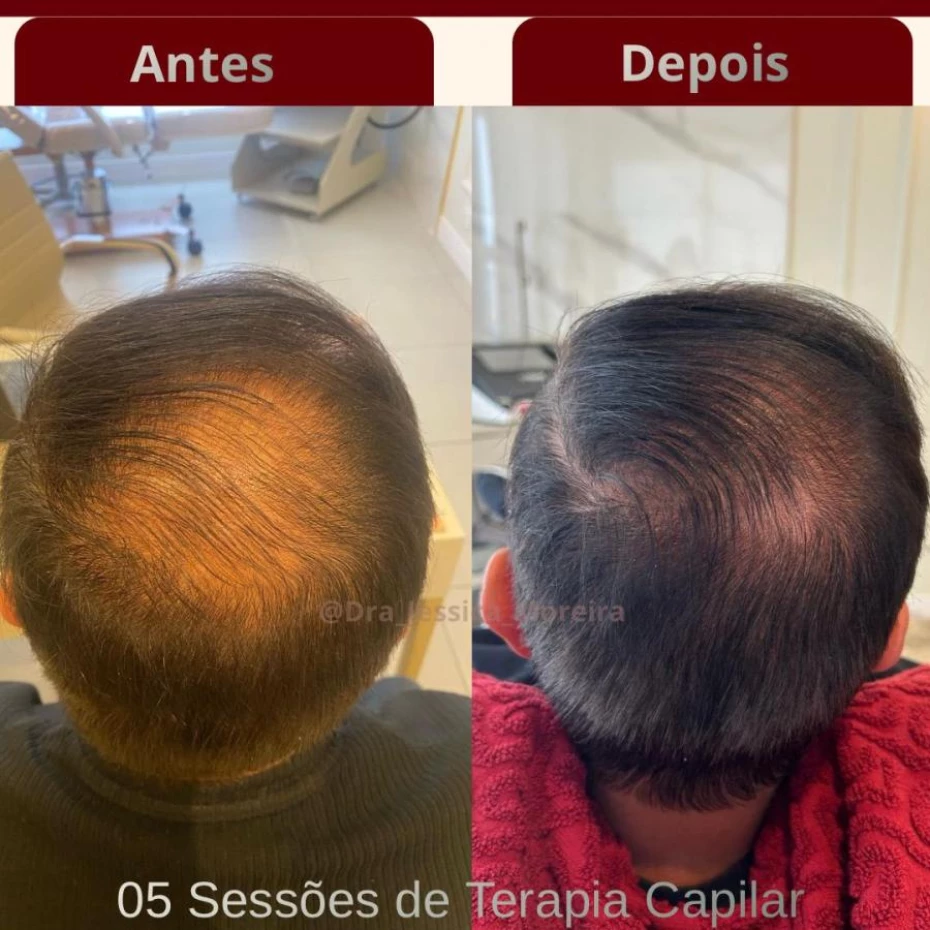 Foto 3:  —  Clínica Dra. Jessica Moreira Saúde e Estética Especializada