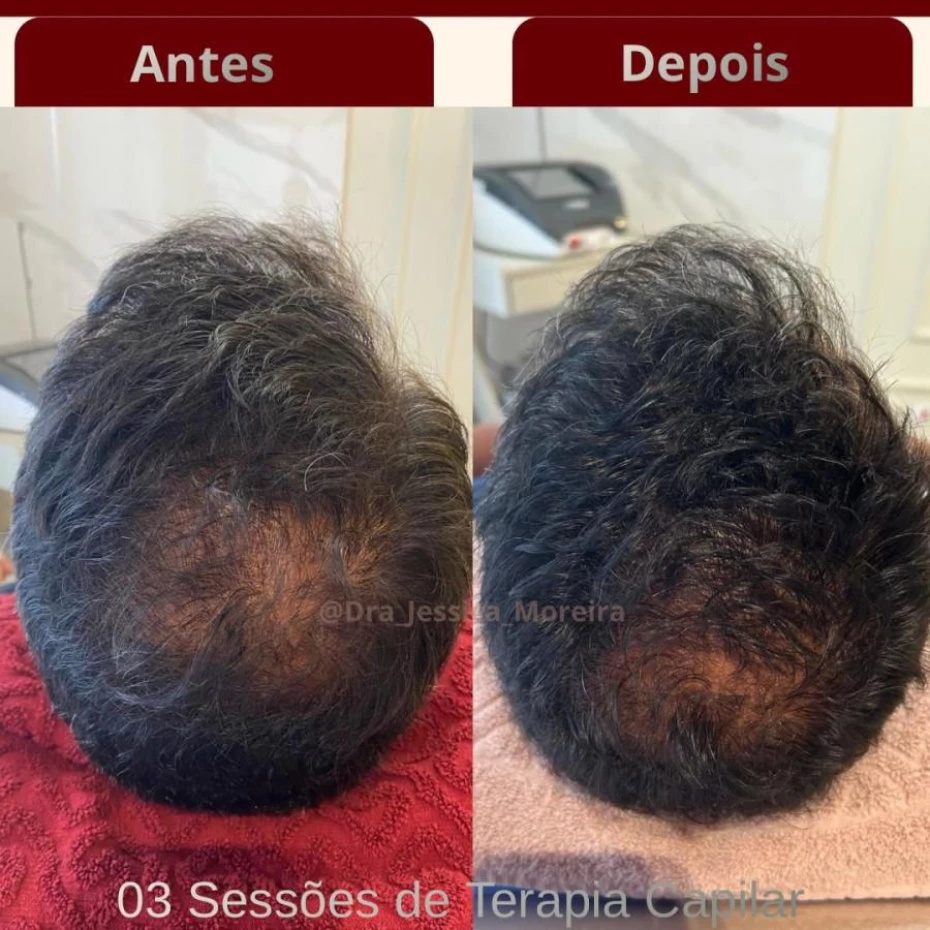 Foto 2:  —  Clínica Dra. Jessica Moreira Saúde e Estética Especializada