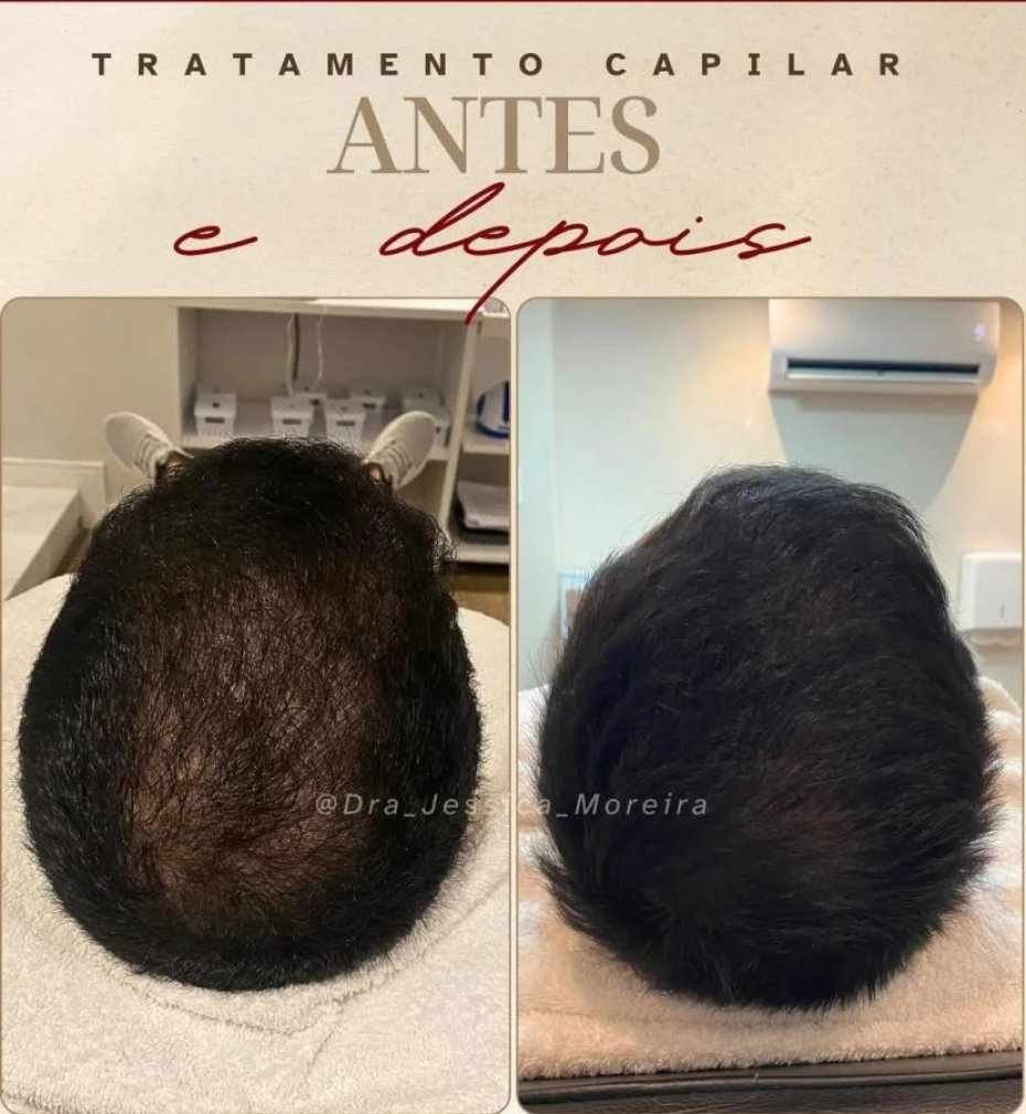 Foto 1:  —  Clínica Dra. Jessica Moreira Saúde e Estética Especializada